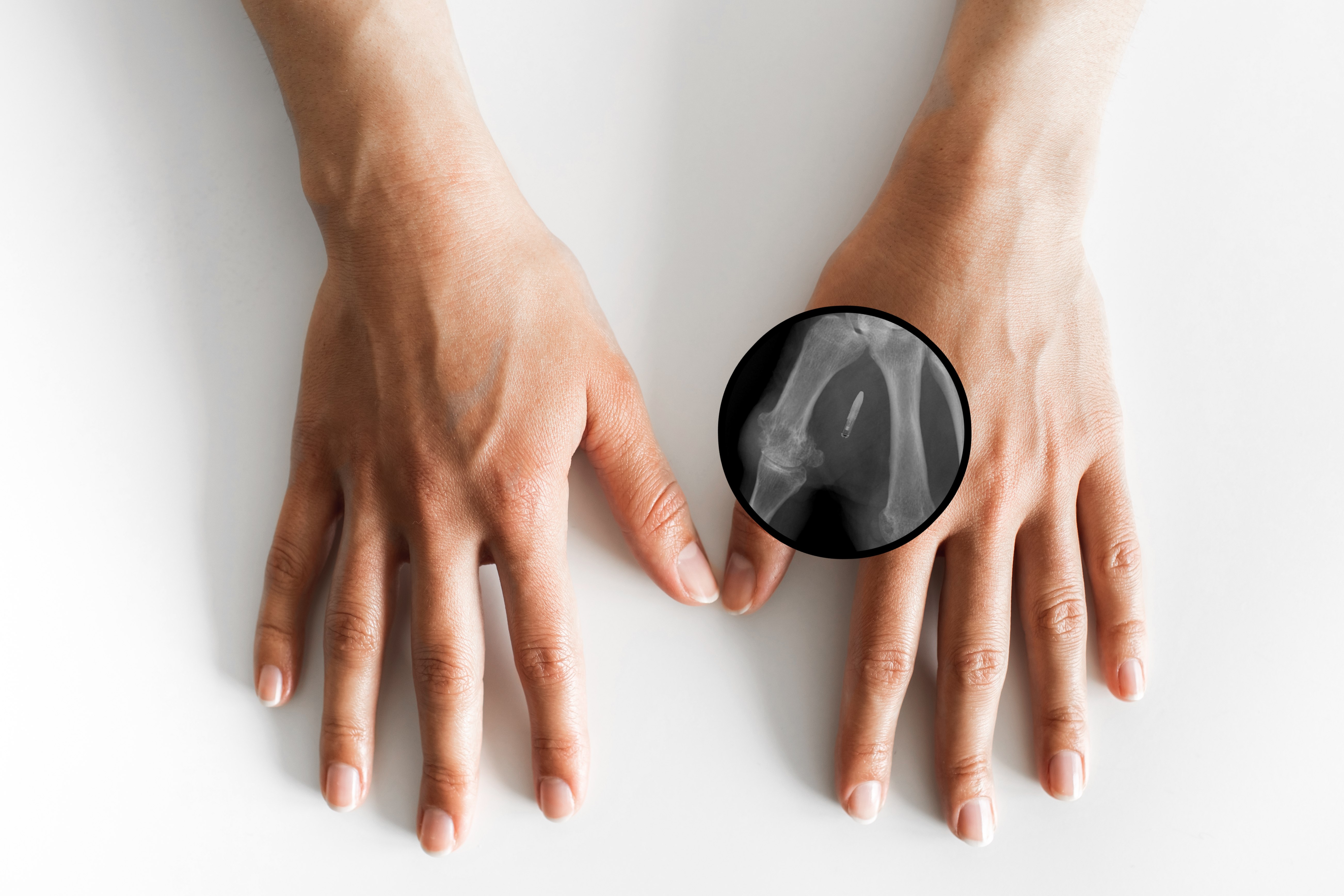 Как работает микрочип-имплант, позволяющий расплачиваться за товары рукой