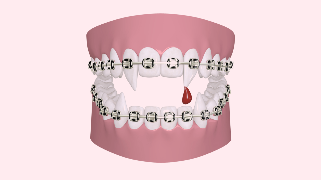Нужны ли Дракуле брекеты?
